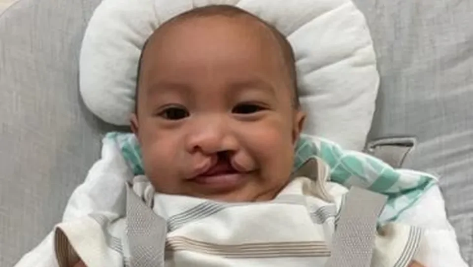 Support Baby Metgot’s Medical Journey to a Brighter Smile – Fundraiser Donation Help