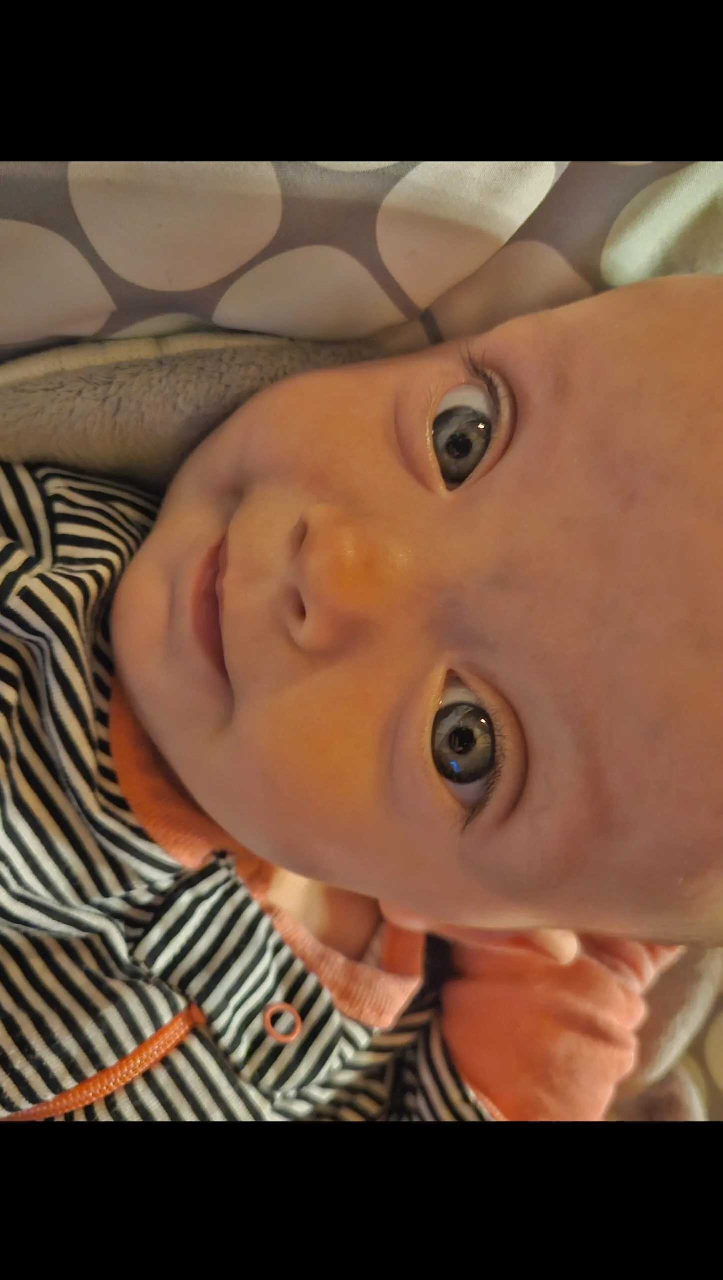 Support for Evelynn’s Craniosynostosis Journey – Fundraiser Donation Help