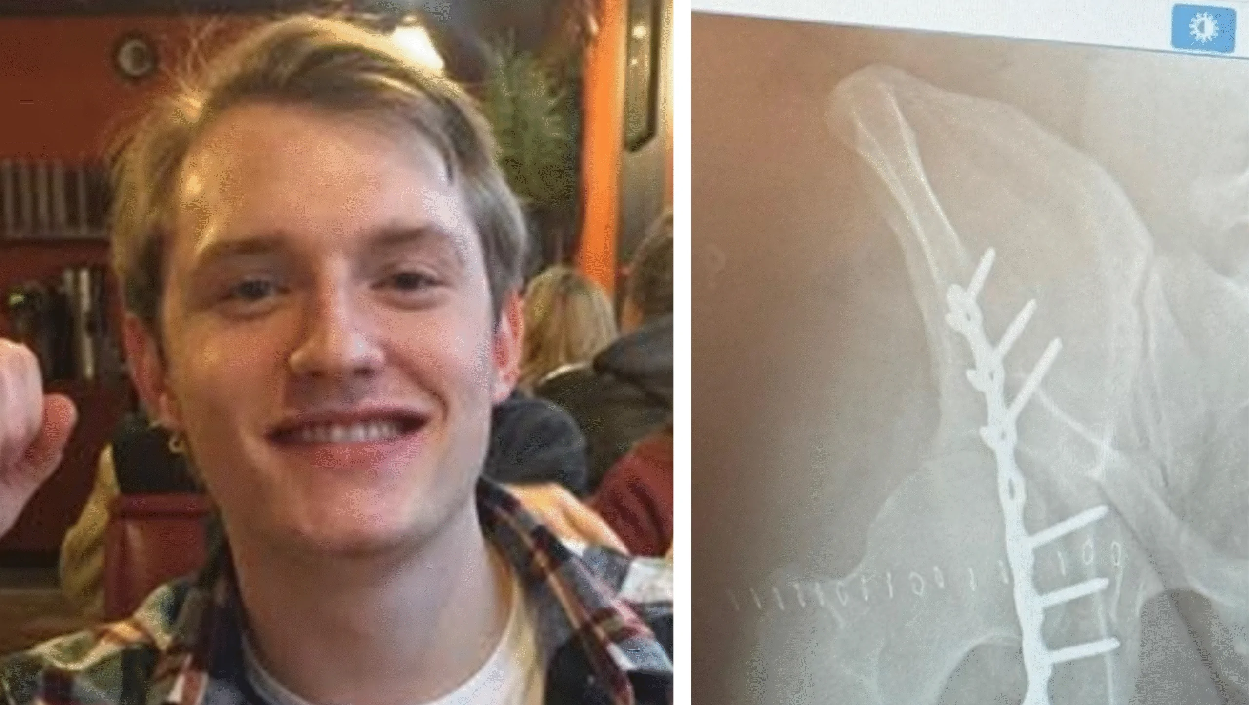 Donate to Brandon Wallace’s Medical Recovery – GoFundMe Fundraiser gofundme Donation Help