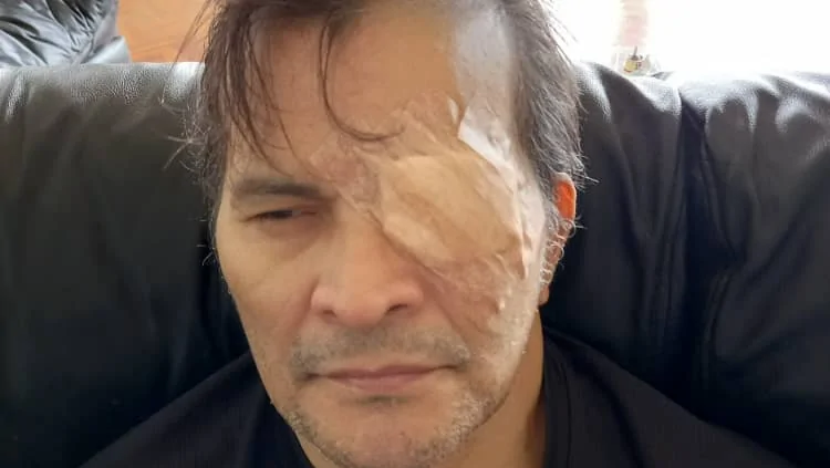 ¡Urgente! Salvemos el Único Ojo de JoséMiguel . – Fundraiser Donation Help