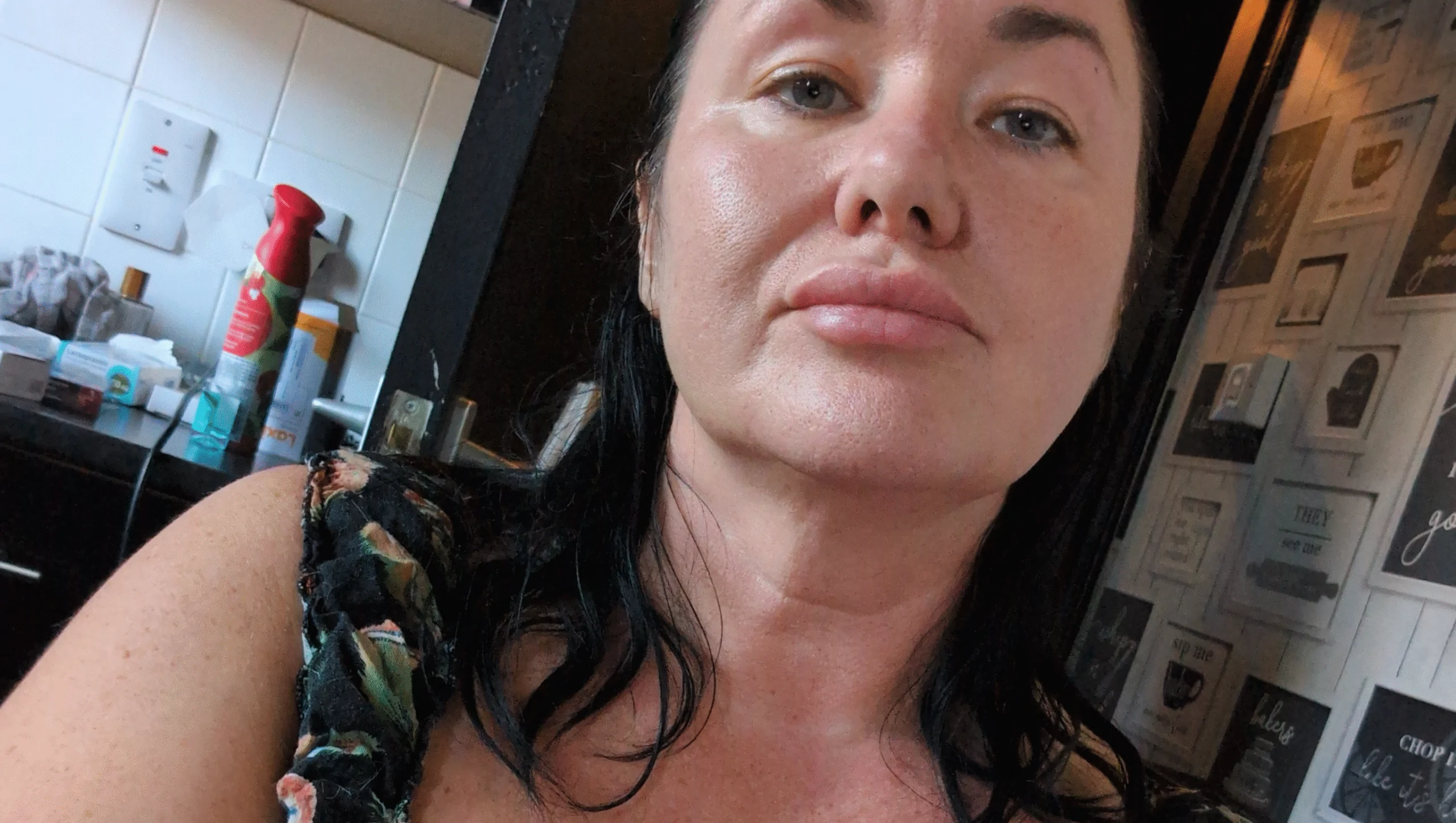 Please Help me heal my brain tumor – GoFundMe Fundraiser gofundme Donation Help