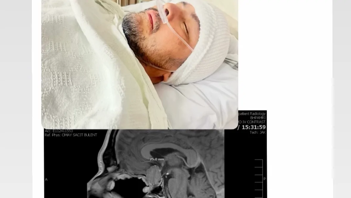 Diego’s Battle: Overcoming Tumor Challenges – Fundraiser Donation Help