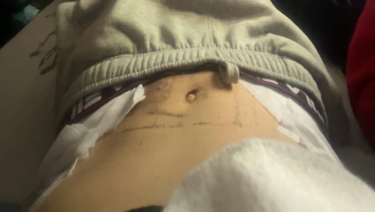 Help Cadan heal from a life changing accident – GoFundMe Fundraiser gofundme Donation Help