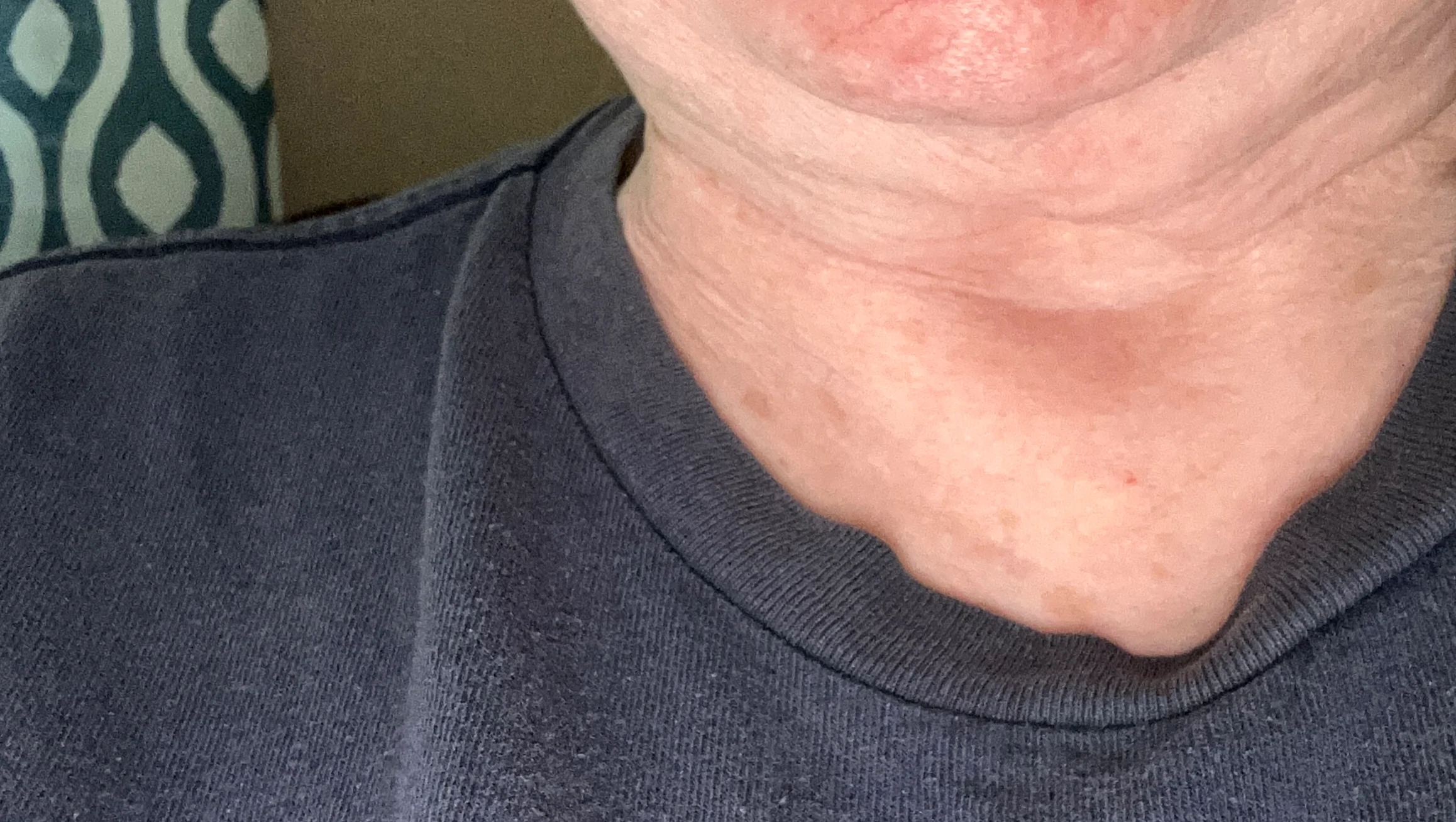 Donate to Restore a Nurse’s Smile – GoFundMe Fundraiser gofundme Donation Help