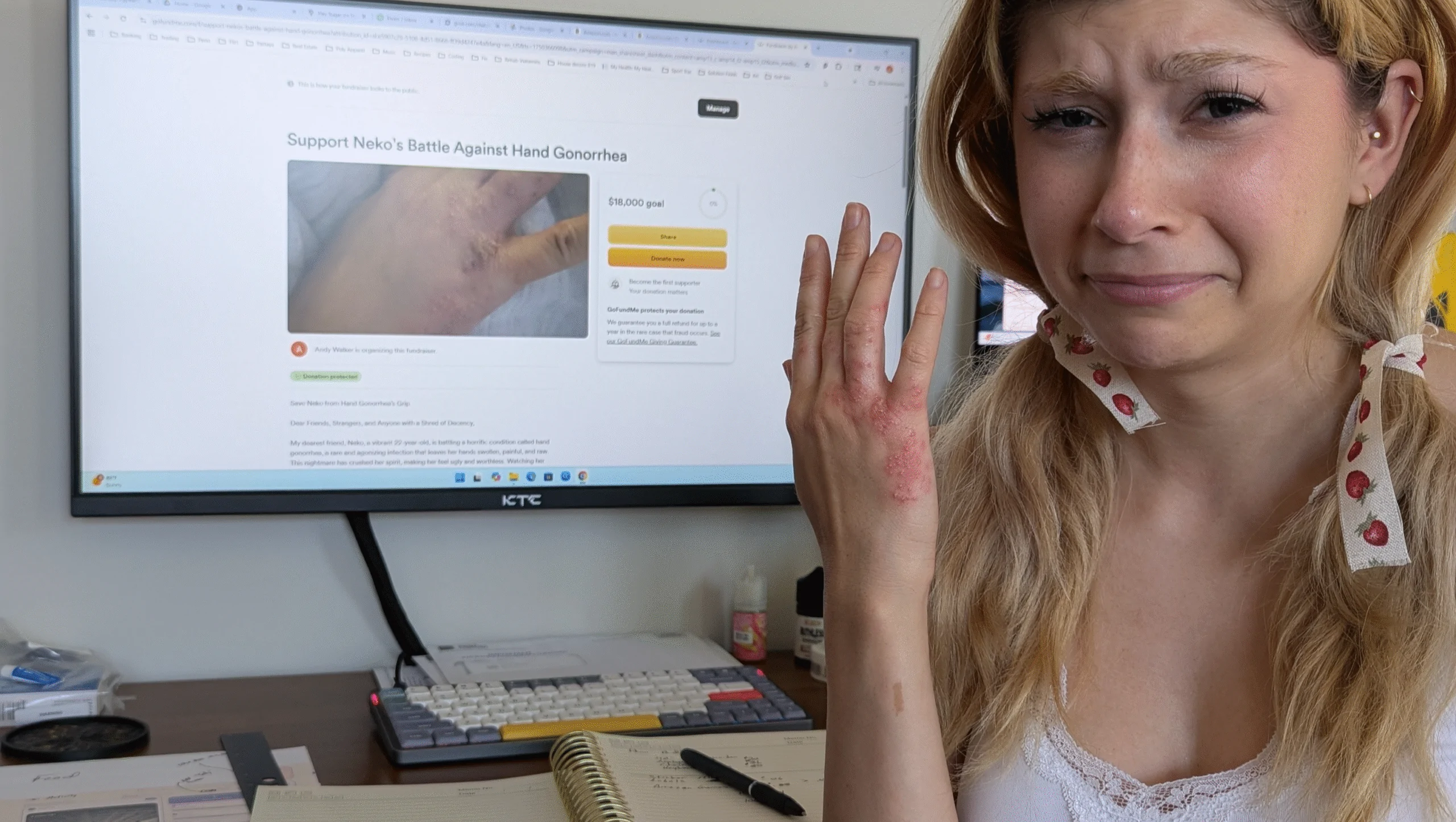Support Neko’s Battle Against Hand Gonorrhea – Fundraiser Donation Help