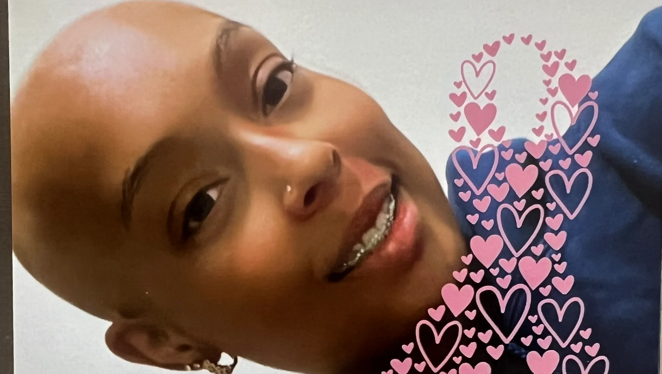 Abigail’s Battle: Cancer-Free but Facing Bills – GoFundMe Fundraiser gofundme Donation Help